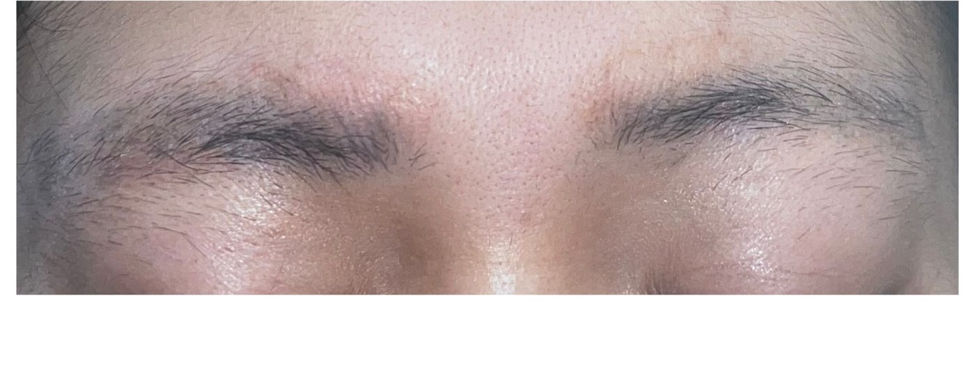 Brows after four sessions