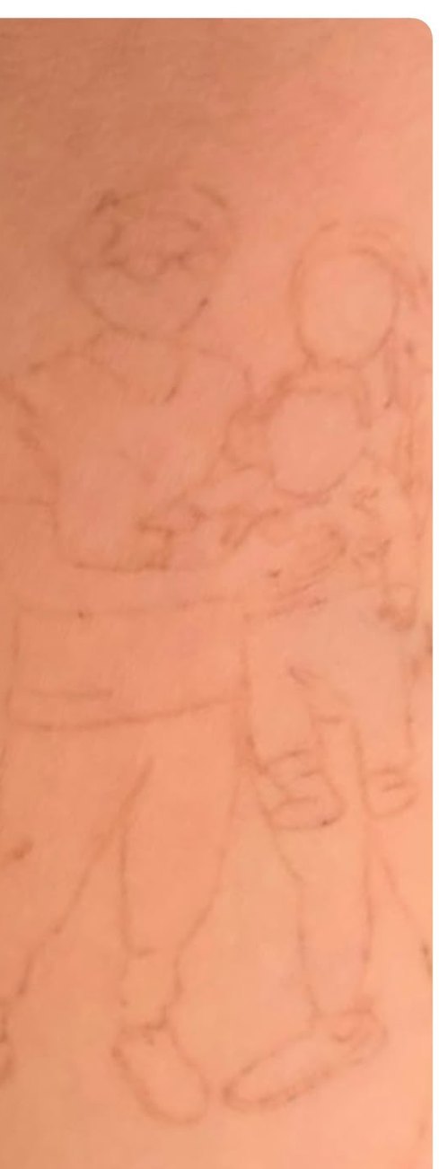 Faded, ready for a cover-up