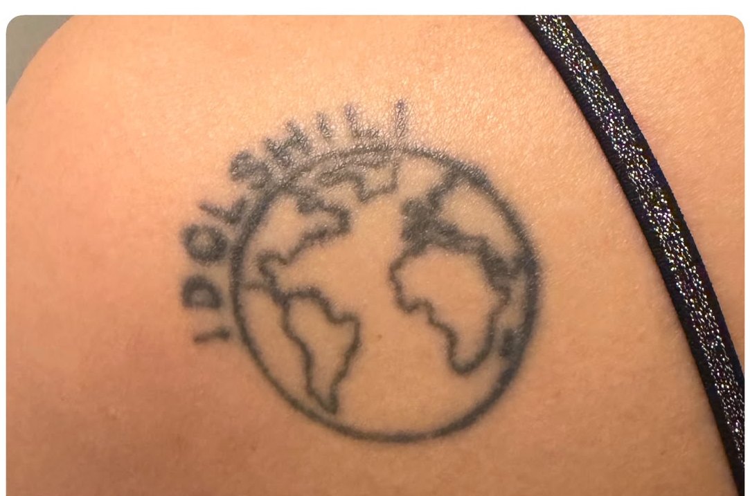 Shoulder tattoo before laser removal, Richmond BC