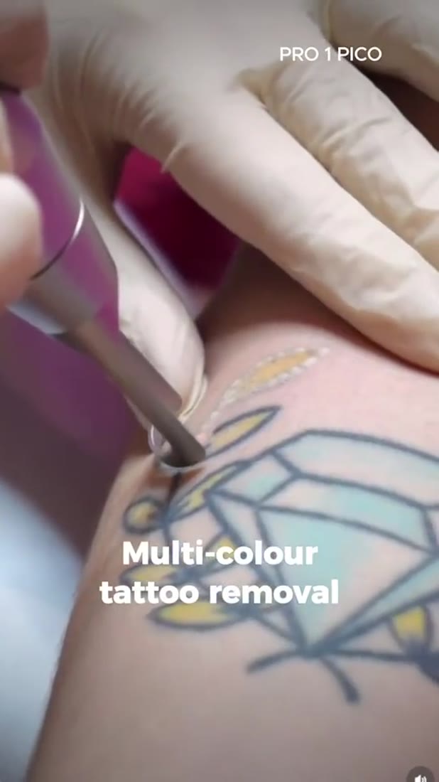 Technician treating a tattoo
